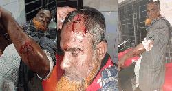 মোহনগঞ্জে গভীর নলকূপ স্থাপন নিয়ে সংঘর্ষ, দা-বল্লমের আঘাতে দুইজন গুরুতর আহত